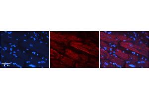 Immunohistochemistry (IHC) image for anti-Growth Regulation By Estrogen in Breast Cancer 1 (GREB1) (N-Term) antibody (ABIN2780943)