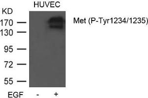 Western blot analysis of extracts from HUVEC cells untreated or treated with EGF using Met (Phospho-Tyr1234/1235) Antibody. (c-MET 抗体  (pTyr1234, pTyr1235))