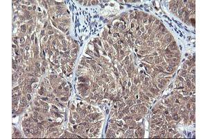 Image no. 1 for anti-Interleukin 1 Family Member 9 (IL1F9) antibody (ABIN1498873) (IL1F9 抗体)