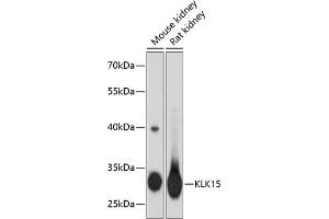 Western blot analysis of extracts of various cell lines, using KLK15 antibody (ABIN3016614, ABIN3016615, ABIN3016616 and ABIN6219799) at 1:3000 dilution. (Kallikrein 15 抗体  (AA 80-180))