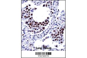 ARIH2 Antibody immunohistochemistry analysis in formalin fixed and paraffin embedded human lung tissue followed by peroxidase conjugation of the secondary antibody and DAB staining. (ARIH2 抗体  (C-Term))