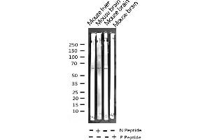 Western blot analysis of Phospho-LKB1 (Thr189) expression in various lysates (LKB1 抗体  (pThr189))