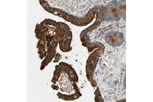 Immunohistochemical staining (Formalin-fixed paraffin-embedded sections) of human colon with SKIL polyclonal antibody  shows strong cytoplasmic and membranous positivity in glandular cells. (SKIL 抗体  (AA 310-448))