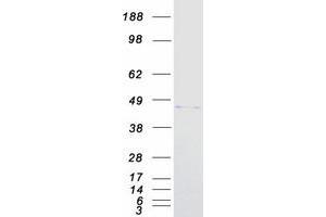 Western Blotting (WB) image for Pancreatic and Duodenal Homeobox 1 (PDX1) protein (Myc-DYKDDDDK Tag) (ABIN2723514)