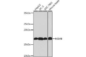 Western blot analysis of extracts of various cell lines, using MSMB Rabbit mAb (ABIN1681107, ABIN3018643, ABIN3018644 and ABIN7101636) at 1:1000 dilution. (MSMB 抗体)