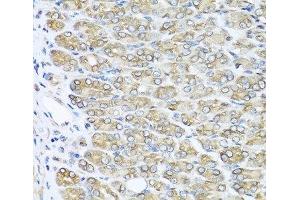Immunohistochemistry (Paraffin-embedded Sections) (IHC (p)) image for anti-Ras-Related C3 Botulinum Toxin Substrate 2 (Rho Family, Small GTP Binding Protein Rac2) (RAC2) antibody (ABIN7255610)