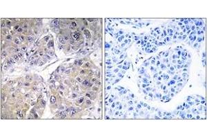 Immunohistochemistry (IHC) image for anti-Solute Carrier Family 27 (Fatty Acid Transporter), Member 5 (SLC27A5) (AA 481-530) antibody (ABIN1534695)
