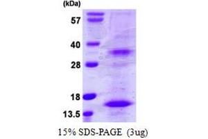 SDS-PAGE (SDS) image for Bone Marrow Stromal Cell Antigen 2 (BST2) (AA 50-161) protein (His tag) (ABIN667927)