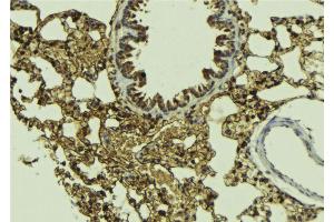 ABIN6268665 at 1/100 staining Mouse lung tissue by IHC-P.