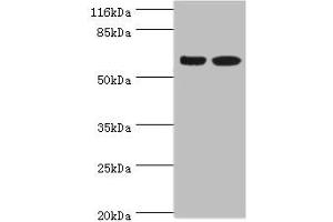 Western blot All lanes: SPATS2L antibody at 8 μg/mL Lane 1: CEM whole cell lysate Lane 2: HepG2 whole cell lysate Secondary Goat polyclonal to rabbit IgG at 1/10000 dilution Predicted band size: 62, 55, 66, 63 kDa Observed band size: 62 kDa (SPATS2L 抗体  (AA 2-488))