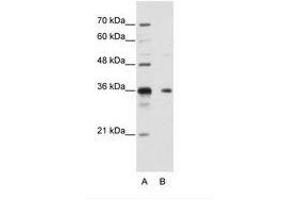 Image no. 1 for anti-Nanos Homolog 1 (NANOS1) (AA 157-206) antibody (ABIN202175) (Nanos Homolog 1 抗体  (AA 157-206))