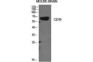 Western Blot (WB) analysis of Mouse Brain cells using CD19 Polyclonal Antibody. (CD19 抗体  (Internal Region))
