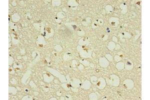 Immunohistochemistry of paraffin-embedded human brain using ABIN7161735 in 30 μg/mL dilute concentrations. (NPPB 抗体)