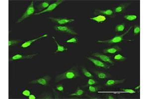 Immunofluorescence of monoclonal antibody to SMAD7 on HeLa cell. (SMAD7 抗体  (AA 160-260))