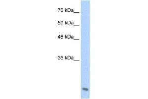 WB Suggested Anti-AES Antibody Titration:  2. (AES 抗体  (C-Term))
