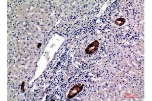 Immunohistochemistry (IHC) analysis of paraffin-embedded Human Liver, antibody was diluted at 1:100. (CD19 抗体  (Internal Region))