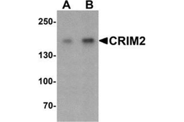 KCP anticorps  (C-Term)