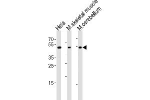 Western blot analysis of lysates from Hela cell line, mouse skeletal muscle and mouse cerebellum tissue lysate(from left to right), using Mouse Hoxc10 Antibody at 1:1000 at each lane. (HOXC10 抗体  (C-Term))