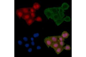 ABIN6256345 and ABIN6267674 staining Hela cells(24h of starvation treatment) by IF/ICC. (PDCD4 抗体  (pSer457))