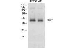 Western Blotting (WB) image for anti-Interleukin 6 Receptor, alpha (IL6RA) (Internal Region) antibody (ABIN3181401) (IL6RA 抗体  (Internal Region))