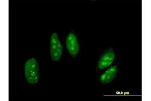 Immunofluorescence of purified MaxPab antibody to ADARB1 on HeLa cell.