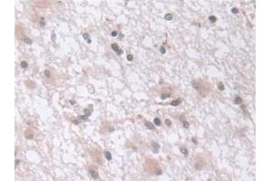 Immunohistochemistry (IHC) image for anti-Exosome Component 2 (EXOSC2) (AA 1-293) antibody (ABIN7441514)
