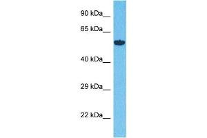 Host:  Rabbit  Target Name:  ALG12  Sample Type:  293T Whole Cell lysates  Antibody Dilution:  1. (ALG12 抗体  (N-Term))
