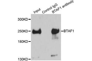 Immunoprecipitation analysis of 150ug extracts of HeLa cells using 3ug BTAF1 antibody (ABIN2561475). (BTAF1 抗体)