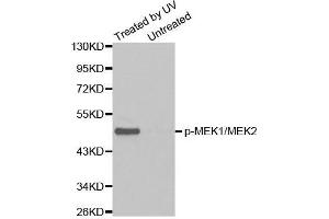 Western blot analysis of extracts from Hela cell untreated or treated with UV using Phospho-MAP2K1/MAP2K2-S217/S221 antibody (MEK1 抗体  (pSer221, Ser217, Ser221))