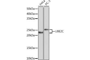 Western blot analysis of extracts of various cell lines, using UBE2C Rabbit mAb (ABIN1680590, ABIN3019392, ABIN3019393 and ABIN7101768) at 1:1000 dilution. (UBE2C 抗体)