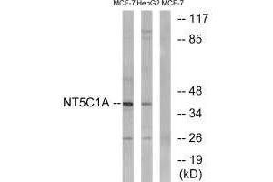 Western blot analysis of extracts from MCF-7 cells and HepG2 cells, using NT5C1A antibody. (NT5C1A 抗体)