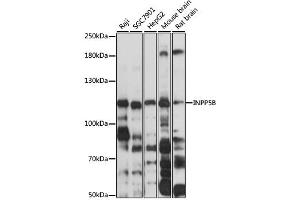 Western blot analysis of extracts of various cell lines, using INPP5B antibody (ABIN6292588) at 1:3000 dilution. (INPP5B 抗体)