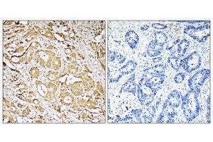 Immunohistochemistry (IHC) image for anti-Fucosyltransferase 3 (Galactoside 3(4)-L-Fucosyltransferase, Lewis Blood Group) (FUT3) (Internal Region) antibody (ABIN1851348) (FUT3 抗体  (Internal Region))