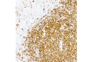 Immunohistochemistry (IHC) image for anti-HLA-DR (HLA-DR) antibody (ABIN7449537) (HLA-DR 抗体)