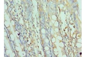 Immunohistochemistry of paraffin-embedded human colon tissue using ABIN7170676 at dilution of 1:100 (SRPK1 抗体  (AA 290-480))