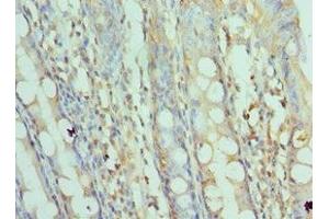 Immunohistochemistry of paraffin-embedded human colon tissue using ABIN7170676 at dilution of 1:100 (SRPK1 抗体  (AA 290-480))