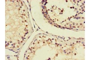 Immunohistochemistry of paraffin-embedded human testis tissue using ABIN7156703 at dilution of 1:100 (AIM2 抗体  (AA 81-326))