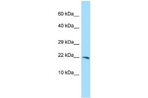 WB Suggested Anti-CXorf40A Antibody Titration: 1. (EOLA1 抗体  (C-Term))