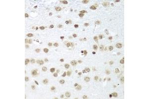 Immunohistochemistry of paraffin-embedded mouse brain using S antibody (ABIN1682621, ABIN3018891, ABIN3018892 and ABIN6220612) at dilution of 1:100 (40x lens). (SAP18 抗体  (AA 21-172))