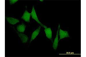 Immunofluorescence of monoclonal antibody to SMAD7 on HeLa cell. (SMAD7 抗体  (AA 302-400))