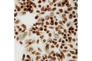 Anti-CTBP2 antibody, ICC ICC: HELA Cell (CTBP2 抗体  (C-Term))