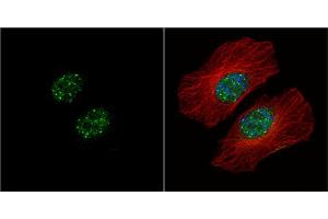 ICC/IF Image HMBOX1 antibody [N3C3] detects HMBOX1 protein at nucleus by immunofluorescent analysis. (HMBOX1 抗体)