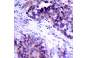 Immunohistochemistry (IHC) image for anti-BCL2-Like 1 (BCL2L1) (pSer62) antibody (ABIN1870015) (BCL2L1 抗体  (pSer62))