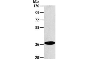 Western Blot analysis of Raji cell using ACMSD Polyclonal Antibody at dilution of 1:400 (ACMSD 抗体)