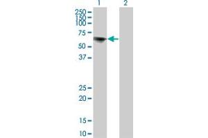 Western Blot analysis of TOE1 expression in transfected 293T cell line by TOE1 monoclonal antibody (M02), clone 1C12. (TOE1 抗体  (AA 1-510))