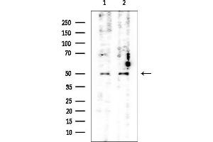 Western blot analysis of lysates from various samples, using Cytokeratin 13 Mouse Monoclonal Antibody at 1/1000 dilution.