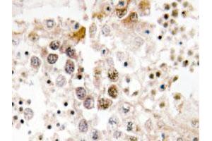 Immunohistochemical analysis of paraffin-embedded human testis tissue using FOXL1 polyclonal antibody . (FOXL1 抗体)