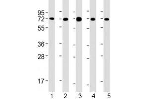 Western blot testing of human 1) MCF-7, 2) PC-3, 3) COS-7, 4) DU-145 and 5) SK-BR-3 cell lysate with USP2 antibody at 1:2000. (USP2 抗体  (AA 1-258))