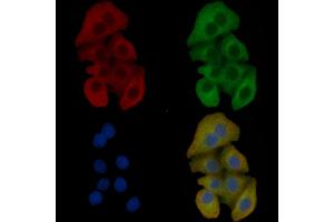 IREB1 Mouse Monoclonal Antibody staining Hela cells by IF/ICC. (Aconitase 1 抗体)