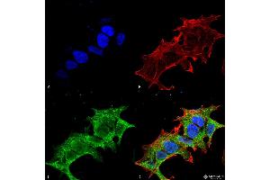 Immunocytochemistry/Immunofluorescence analysis using Mouse Anti-GIT1 Monoclonal Antibody, Clone S39B-8 . (GIT1 抗体  (AA 375-770) (FITC))
